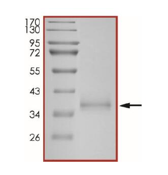 The purity of 2019-nCoV Spike protein S1 subunit, RBD (K417N, L452R, T478K) was determined to be >90% by densitometry